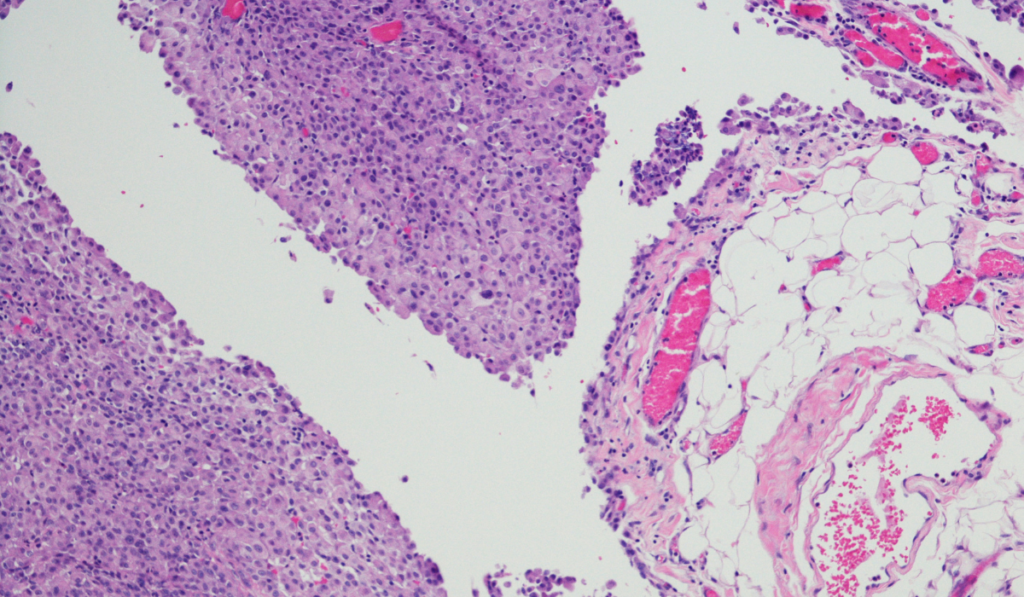 Crisp Mesothelioma Cell Line Image Concept Crisp Mesothelioma Cell Line Image Concept