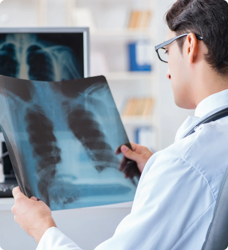 doctor looking at chest xray