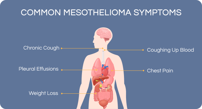 Common Symptoms of Mesothelioma