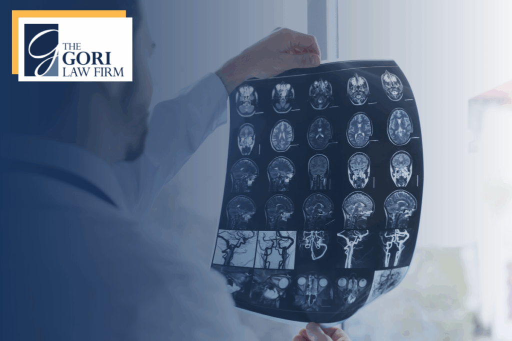 A Dr holding up multiple images of a brain